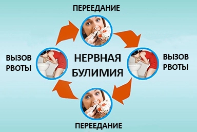 Лечение булимии в Краснобродском